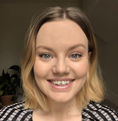 invisalign Vorher Bild